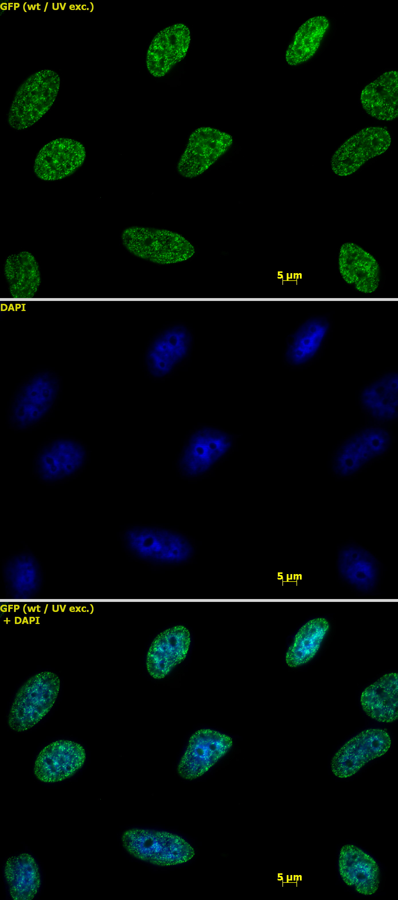 Histone H K Me Antibody Pab United Bio Research