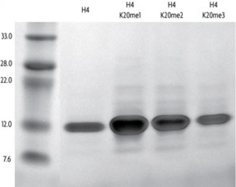 15+sds+page+gel