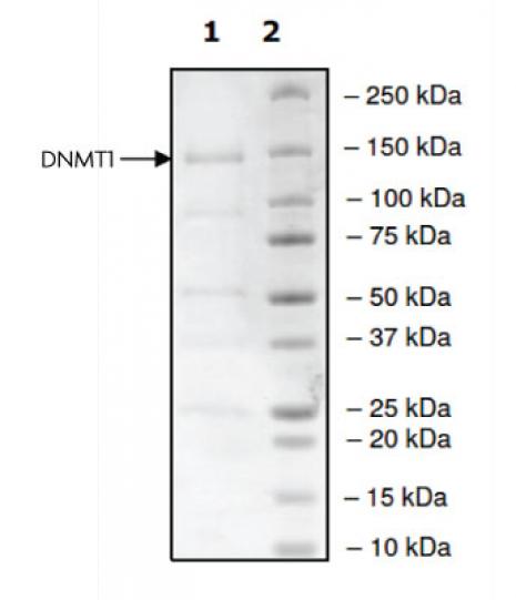 Sds+page+gel+staining