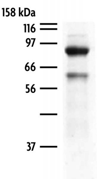 Sds+page+gel+staining