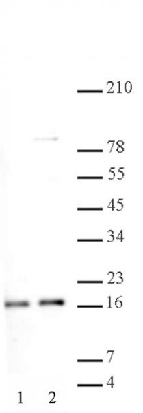 Histone H2A, acidic patch antibody (pAb) tested by ChIP.