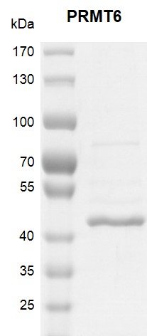 Recombinant PRMT6 protein 10% SDS-PAGE Coomassie staining MW: 43.7 kDa Purity: ≥ 85%