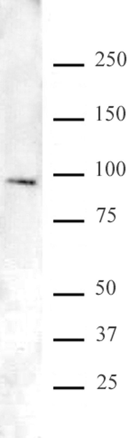 Foxo1 Fkhr Antibody Pab