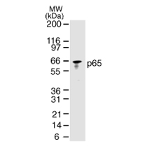NF-kB p65 (RelA) antibody (Clone 112A1021)