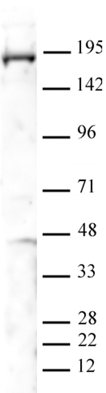 PBRM1 antibody (pAb)