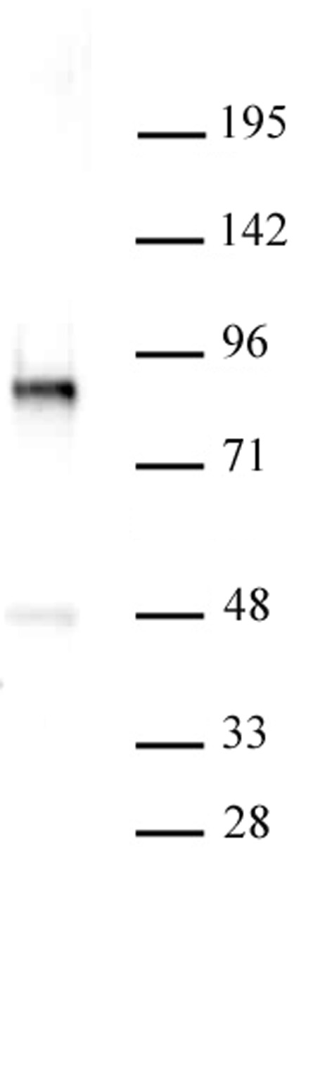 PRKCB Antibody (pAb)