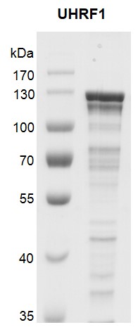 Recombinant UHRF1 protein - United Bio Research