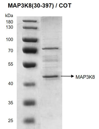 Recombinant MAP3K8 (30-397) / COT protein - United Bio Research