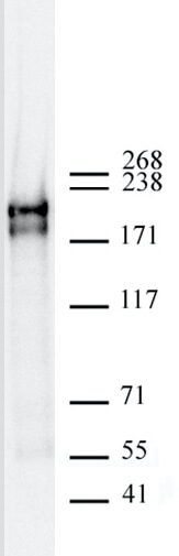 AbFlex DNMT1 recombinant antibody for Western blot