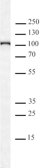 AbFlex® KDM1B / LSD2 Recombinant Antibody