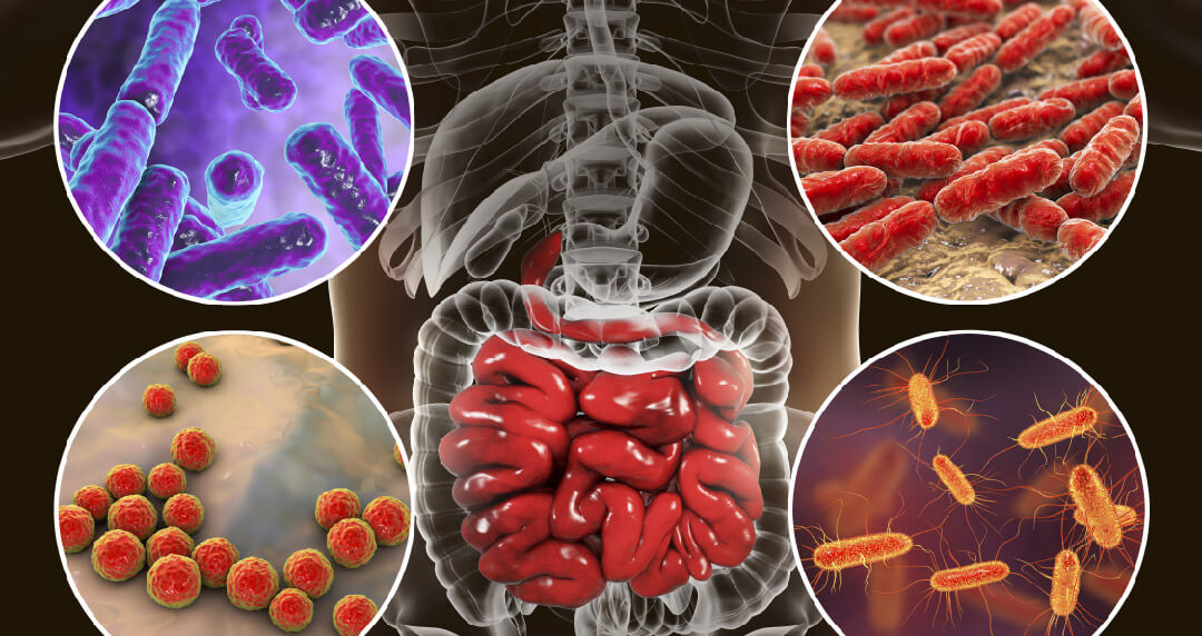 Alzheimer’s Disease: The Impact of Gut Bacteria and Hippocampal DNA Methylation