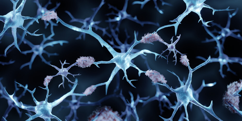 Microglial