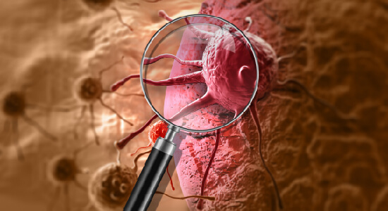PROTAC-mediated Targeted Protein Degradation in Cancer: PARP, EGFR, and SMARCAs in Focus